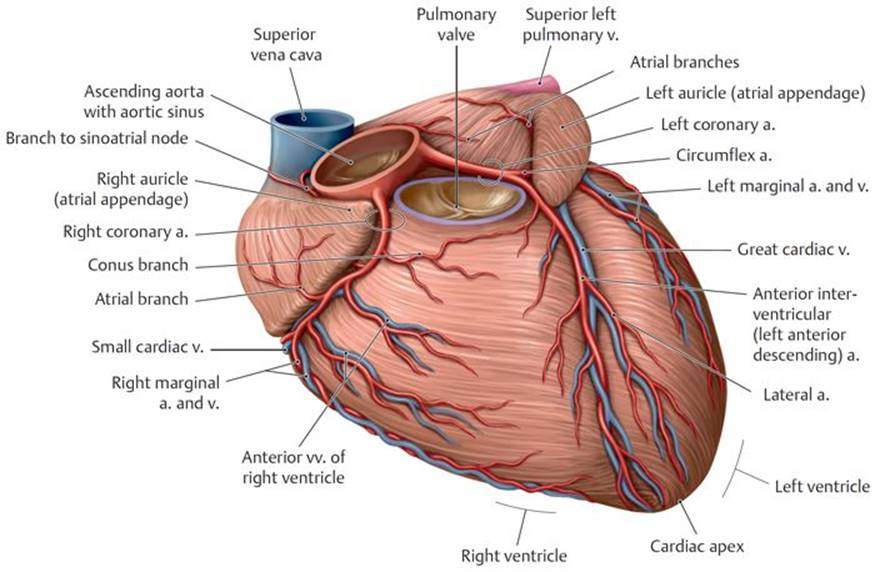 СБУГ — Аномальное отхождение коронарной артерии от легочной артерии